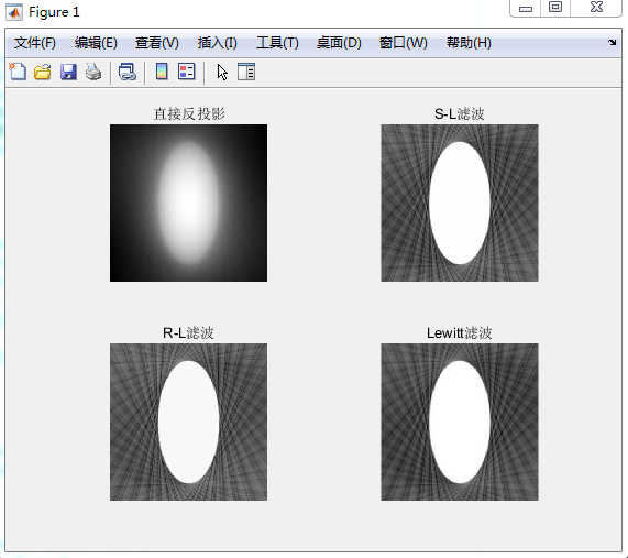 matlabҽѧ˲ͶӰ,ֱӷͶӰ,S-L˲,R-L˲,Lewitt