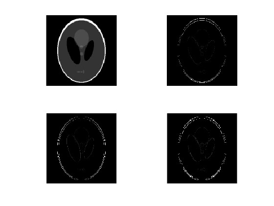 mshepp-Loganģͺ˲ͶӰҽѧͼ߶ȫؽ;ֲؽmatlab